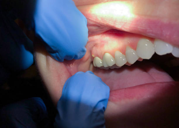Best Broken or Cracked Tooth Emergency Dentist in Helena West Side, MT