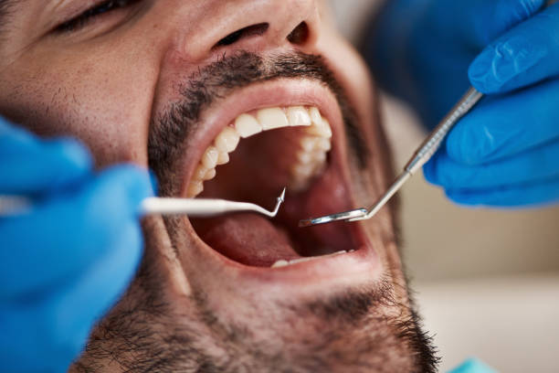 Best Emergency Dental Care for Abscessed Tooth in Helena West Side, MT